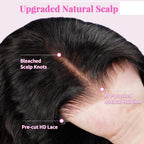 Close-up of a hairline with text labels on an upgraded natural scalp.