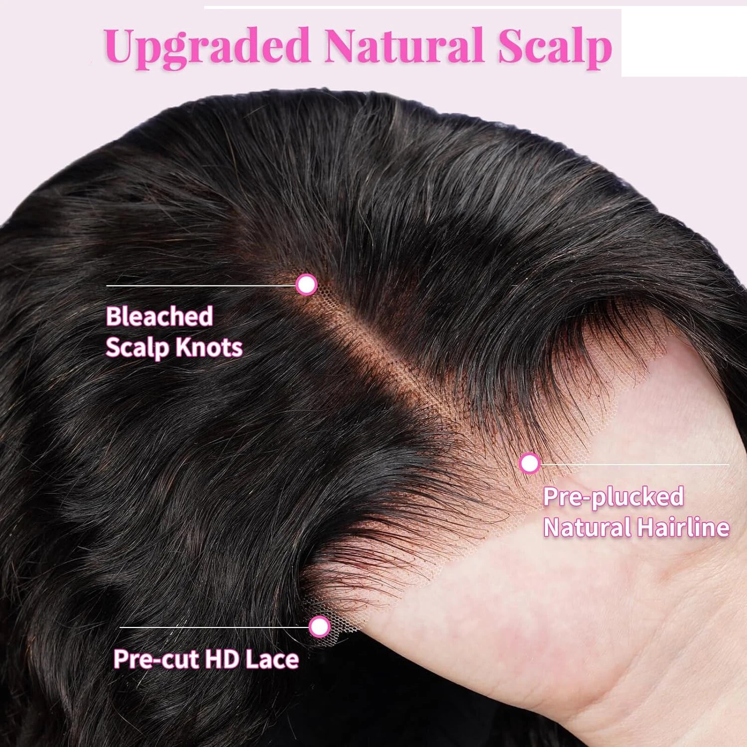 Close-up of a hairline with text labels on an upgraded natural scalp.